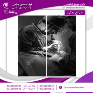 جراح بینی - دکتر محمد ابراهیمی