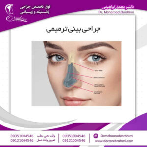 جراحی بینی ترمیمی - دکتر محمد ابراهیمی