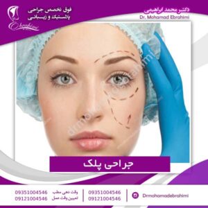 جراحی پلک - دکتر محمد ابراهیمی