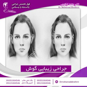 جراحی زیبایی گوش - دکتر محمد ابراهیمی