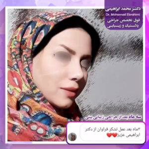 جراحی زیبایی بینی - دکتر محمد ابراهیمی