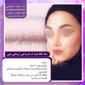 جراحی زیبایی بینی - دکتر محمد ابراهیمی