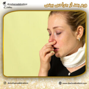 ورم بعد از جراحی بینی - دکتر محمد ابراهیمی
