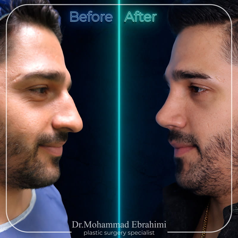 نمونه کار عمل بینی