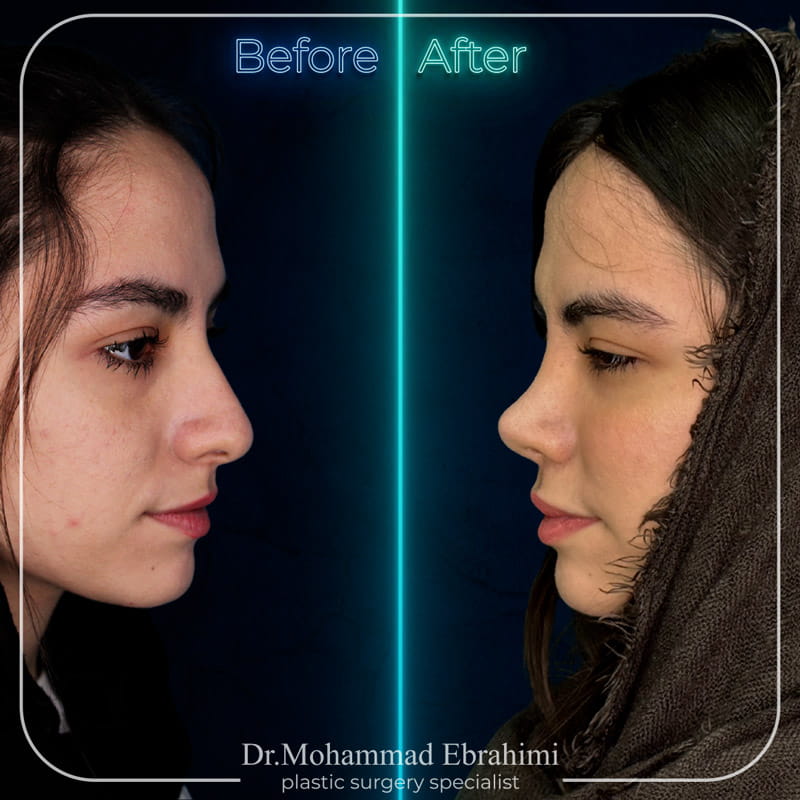 نمونه کار عمل بینی