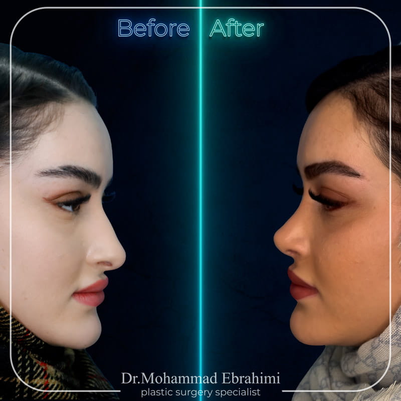 نمونه کار عمل بینی
